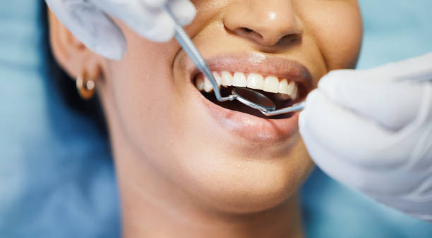 Best Broken or Chipped Tooth Repair in Port Dickinson, NY